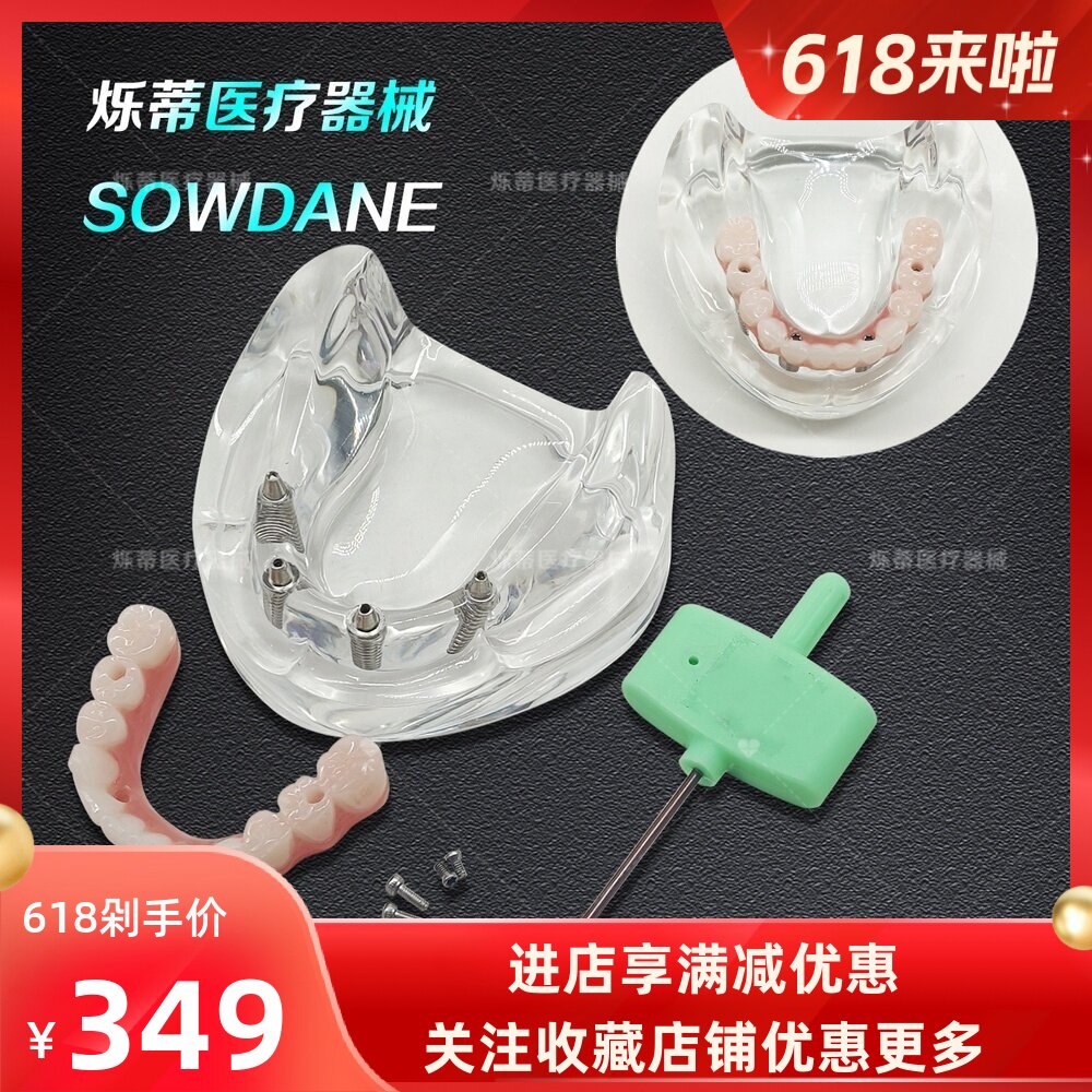 牙科马龙连桥义齿修复模型仿真义齿种植口腔教学牙模型