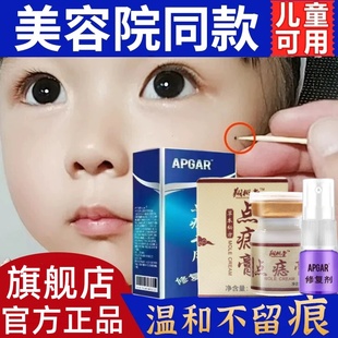 点痣膏无痕点斑去痣水志脸部专用除祛黑痣膏修复液正品旗舰店官方