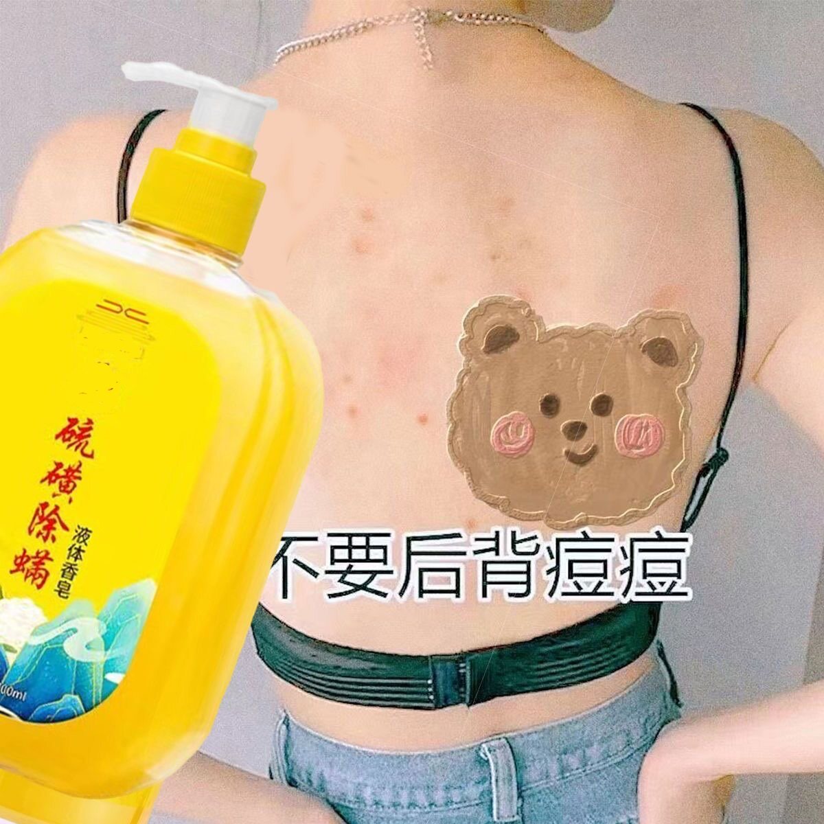 买1发4硫磺除螨沐浴露男士去除螨虫净螨虫硫磺皂背部止痒除菌香皂