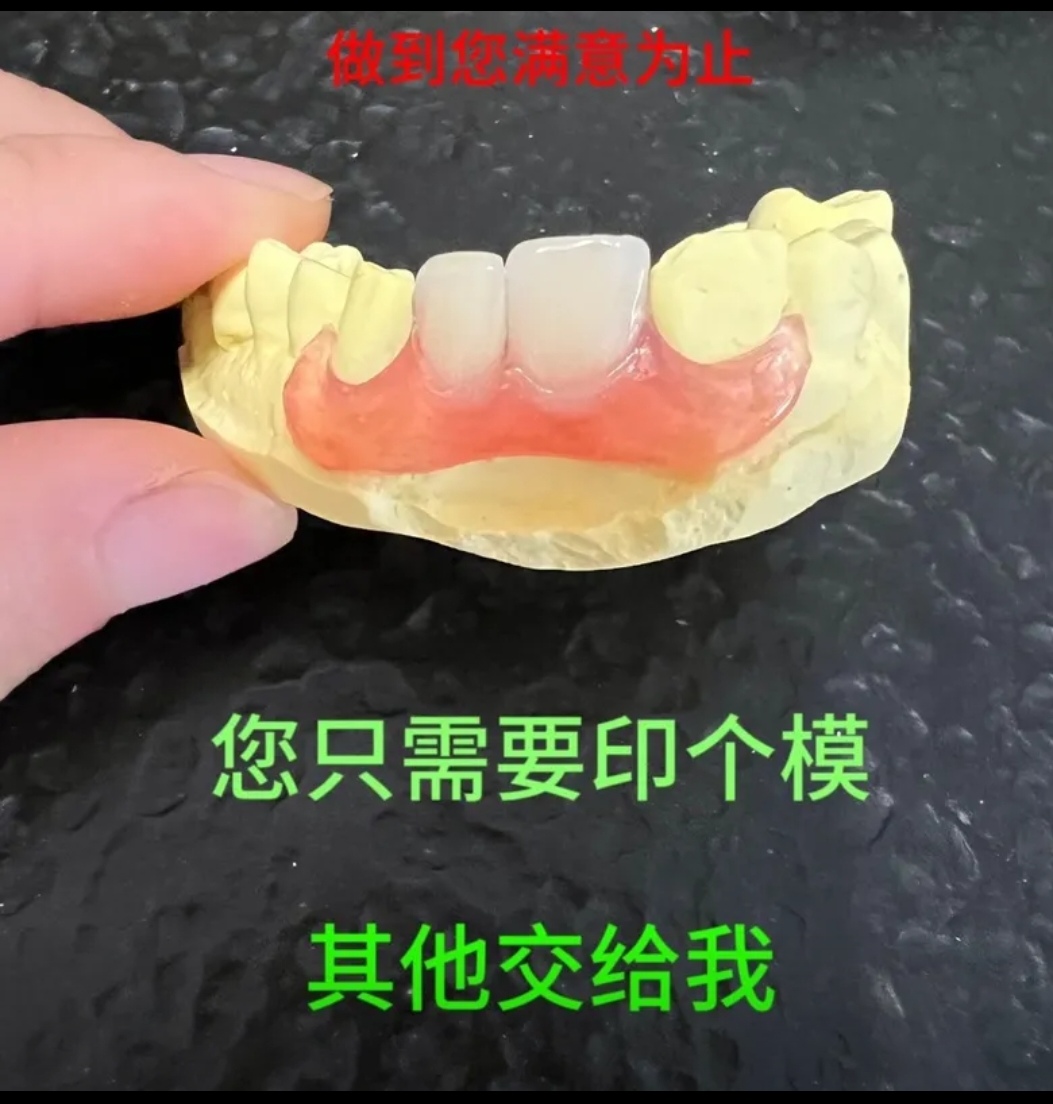 促销牙模取牙模材料工具包模型材料印膜材矫正牙齿模型透明牙套