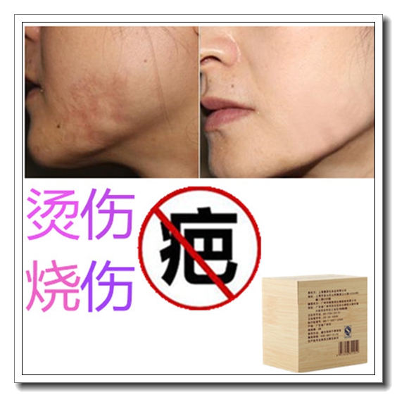 消除儿童增生性凹凸疙瘩祛旧烧伤药烟烫疤痕印正品淡化黑色素沉着