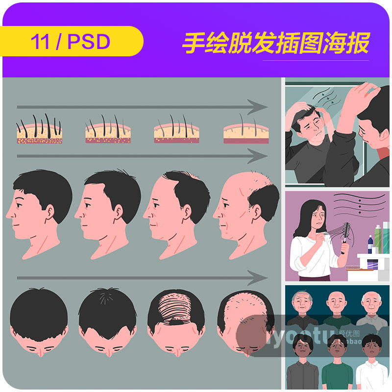 手绘卡通人物中年男士女士脱发植发插图海报psd设计素材i2351803