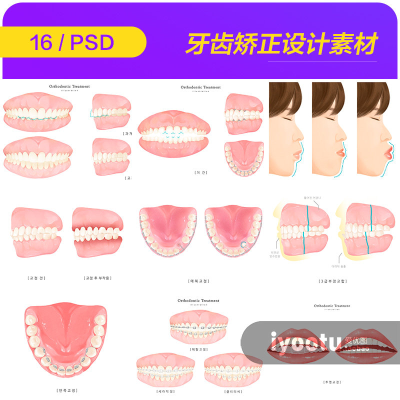 手绘口腔护理牙齿矫正医疗健康整设计素材/源文件