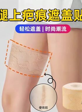 夏季遮疤痕小腿手臂腿部胎记伤痕遮盖贴装饰遮瑕夏天遮疤神器蕾丝隐形胶布专业隐藏纹身自粘弹力带无痕肉色贴