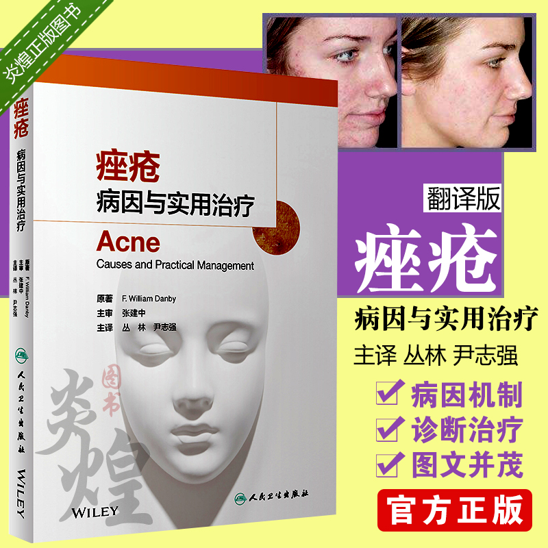 S痤疮 病因与实用治疗 护肤祛痘皮肤病青春痘治疗丛林尹志强 皮肤组织性病学美妆书 9787117285773人民卫生出版社