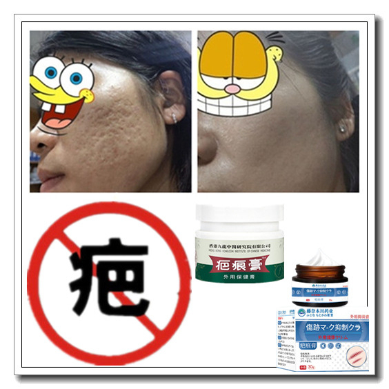 去儿童增生性体质凸出手术后疙瘩剖宫产刮伤疤痕印缝针抓伤精华液