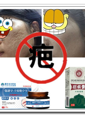 去除疙瘩修复增生性凹凸疤祛手术烟烫色素烧伤巴痕灵激光正品软膏