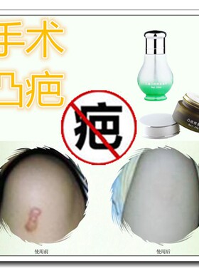 消除脸部伤疤痕灵凝胶修复增生去凸起耳洞肉巴疙瘩遮瑕膏遮盖纹身