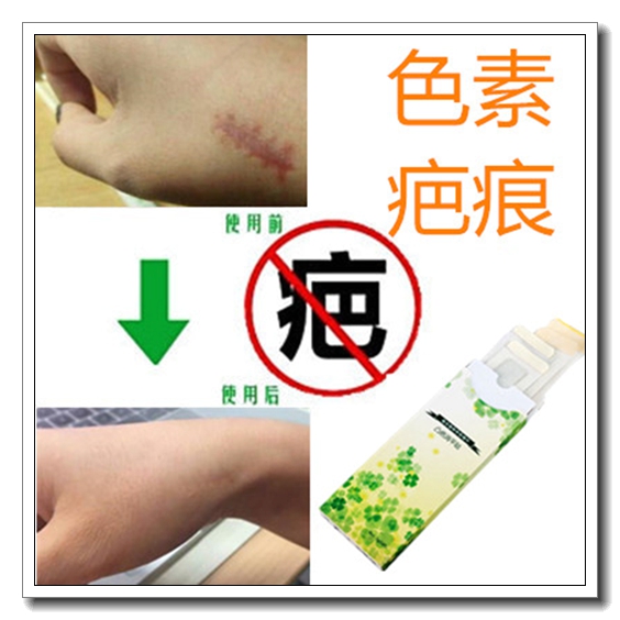 祛男女脸上增生痘疤痕印淡化抓痕黑印面部去除黑色素沉淀阻断回流