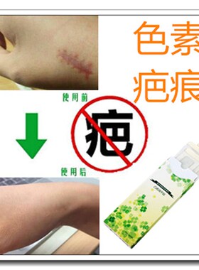 祛男女脸上增生痘疤痕印淡化抓痕黑印面部去除黑色素沉淀阻断回流