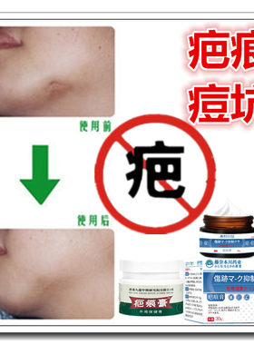 消去凸疙瘩修复增生性手术剖宫产祛除伤疤痕印灵纹身沉着色素正品