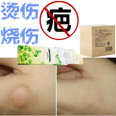 去除旧烟烫增生修复烧伤软化疙瘩淡化黑色素祛凹凸巴缝针烟疤痕印