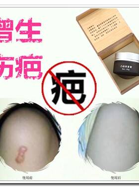 去除手术伤疤痕正品消疤灵草本巴痕修复膏去脸部抓伤缝针疤的药膏