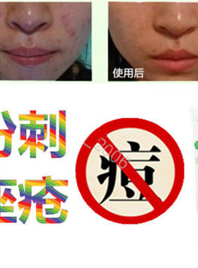 产品痘痘印痘疤去后背部修复霜胸前豆豆祛除男女士痘痕印暗疮正品