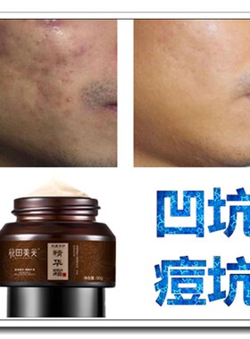 去除手术凹陷疤痕灵凹疤修复生长膏快速填平祛凹坑痘疤痘坑霜正品