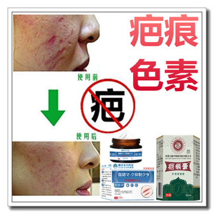 草本去除黑色素沉着修复膏淡化黑印祛男女士色素印痕疤痕印伤疤贴