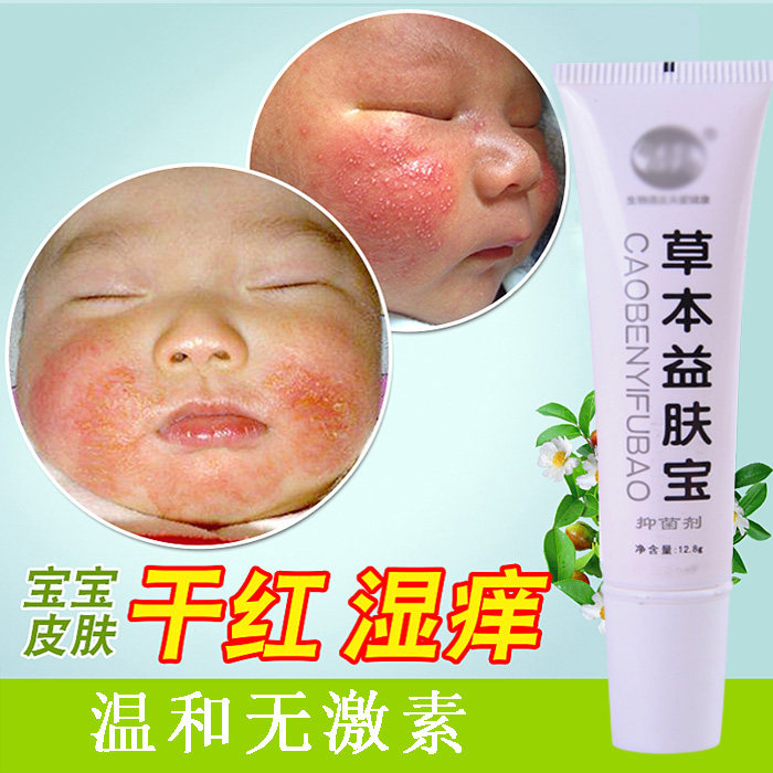 草本益肤宝婴儿无激素红疹膏奶痂奶藓止痒膏去痱霜宝宝维肤膏|msdalam kategori lampin/Xihu/makan/push pelarik, Mandi produk penjagaan kulit bayi, krim pelembab - dari Buy2taobao.com untuk memberikan perkhidmatan ejen Taobao profesional membeli