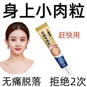 正品脖子肉粒颈部全身脸部手脚腋下云南本草质膏丝状疙瘩