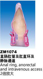 ZM1074直肠肛管及肛直环及静脉通道解剖模型
