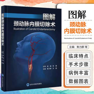 图解颈动脉内膜切除术焦力群马妍宣武医院脑缺血治疗系列围术期影像学评估手术操作细节北京大学医学出版社颈动脉疾病外科手术