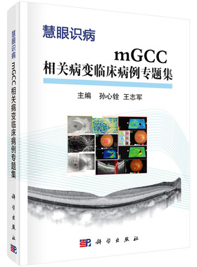 mGCC相关病变临床病例专题集  孙心铨 王志军 眼科学临床病例