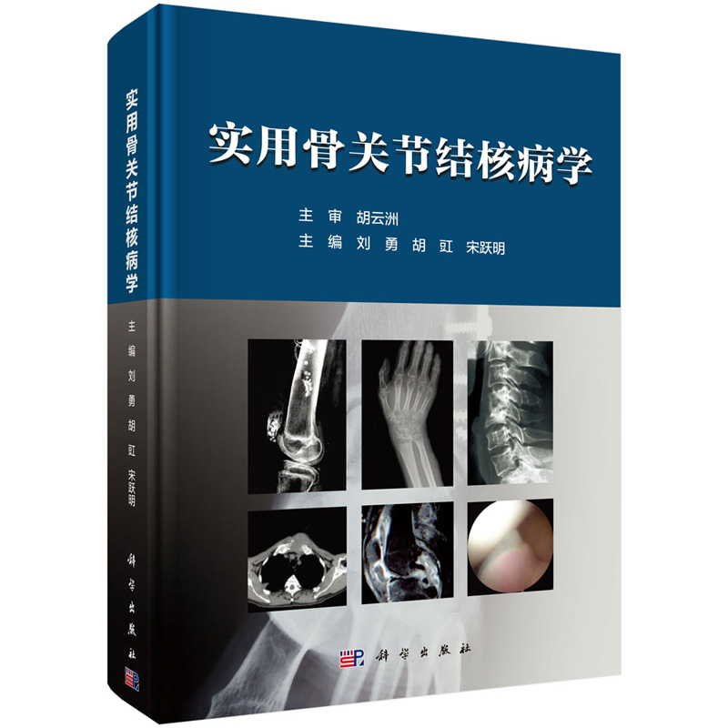 【正版现货】实用骨关节结核病学 刘勇 等编 9787030579843 科学出版社