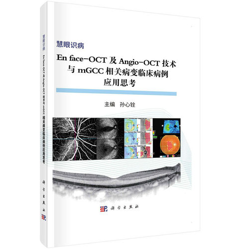 En face-OCT及Angio-OCT技术与mGCC相关病变临床病变应用思考 孙心铨 编著 9787030583192 慧眼识病 科学出版社