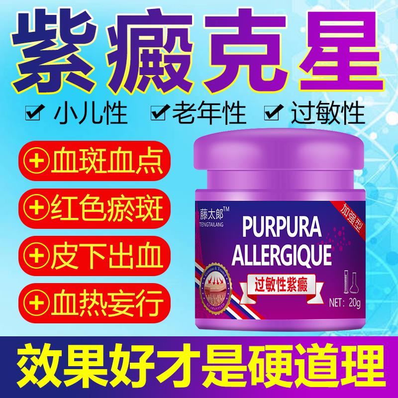 专治疗过敏性紫癜特效药膏
