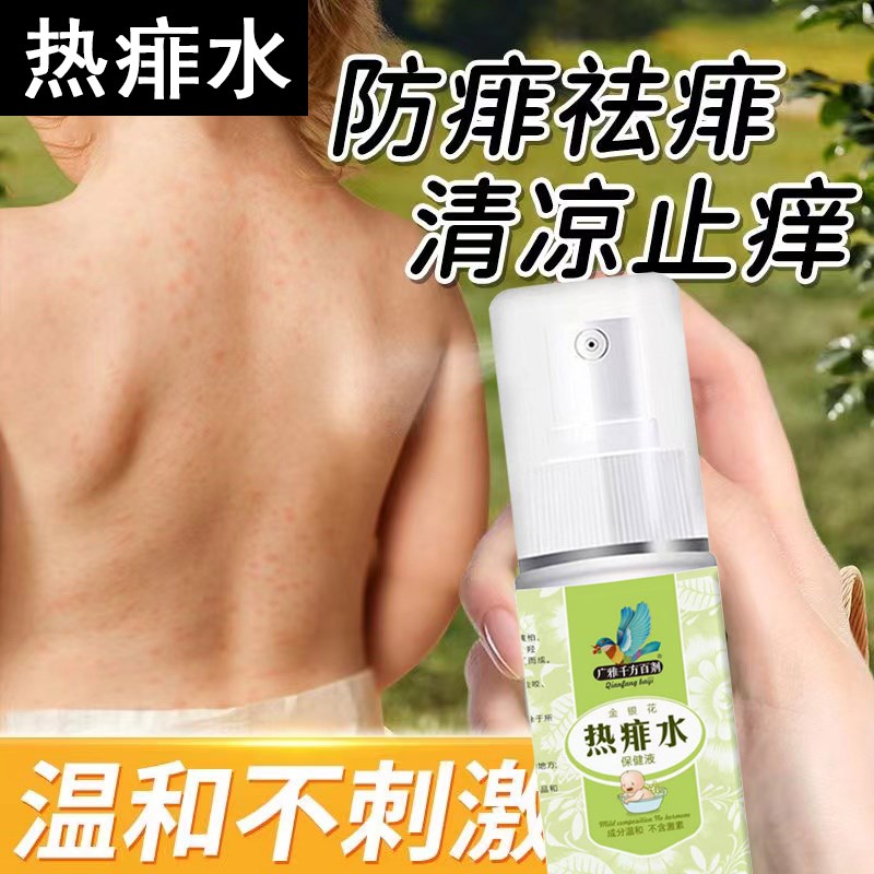 痱子止痒水成人去痱子喷雾液体祛痱膏治除热痱子水大人防菲神器药