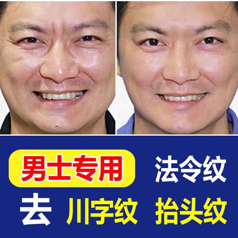 男士皱纹神器法令纹颈纹川字额头抬头眼纹妊娠抗皱衰老紧致精华液