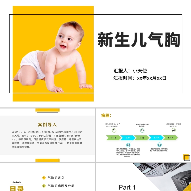 PPT代制作婴儿护理新生儿气胸护理查房气胸患者PPT模板