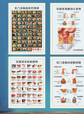 医院肛肠科挂图宣传画海报肛门直肠内外痔疮示意图谱墙贴纸WSD18