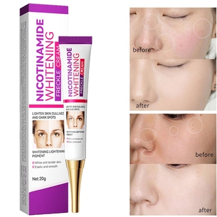 Nicotinamide Whitening Dark Spots Cream Freckle Removal Brig