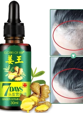 Hair Loss Treatment Ginger Growth Essence Oil老姜头发养护油