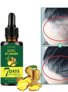 Hair Loss Treatment Ginger Growth Essence Oil老姜头发养护油