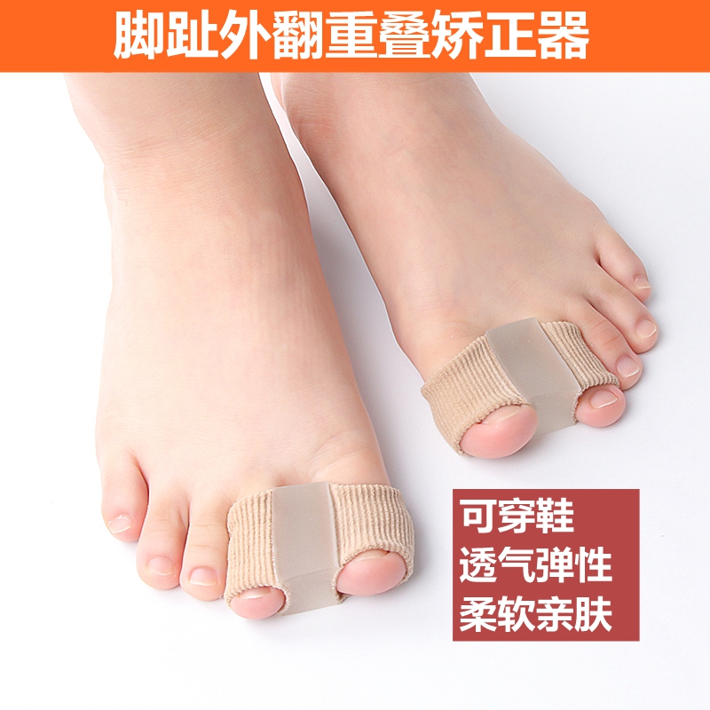 拇外翻脚趾重叠矫正器