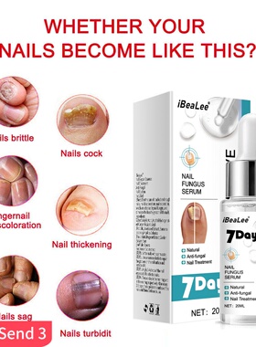 iBeaLee Repair Grey Nail Fungus Treatments Essence Foot Car