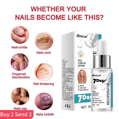 iBeaLee Repair Grey Nail Fungus Treatments Essence Foot Car
