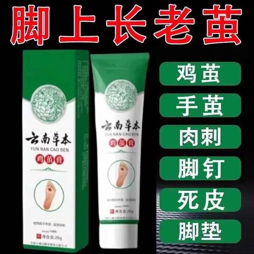 鸡茧膏去除脚底老茧软化剂脚底死皮脚跟脚垫硬皮鸡眼药膏祛除脚钉