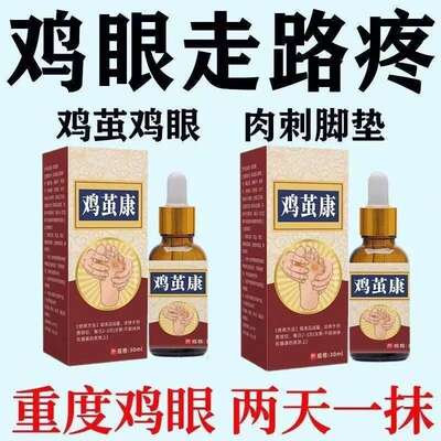 【鸡茧康】去除脚茧老茧手足厚茧硬皮鸡眼身体脚趾关节茧脚垫老茧