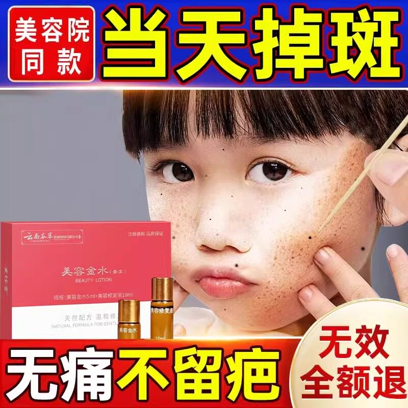 祛斑一擦就掉专用药水去斑祛黄褐乳液/面霜