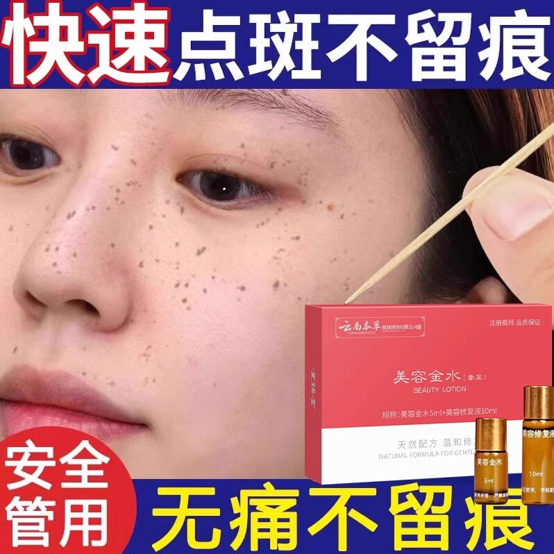 祛斑一擦就掉专用药水去斑祛黄褐乳液/面霜