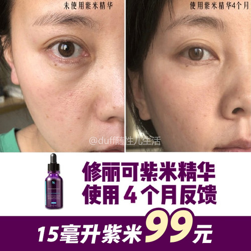 旧版紫米绝唱局。不过百。15ML！垮脸飞升！修丽可玻色因紫米精华