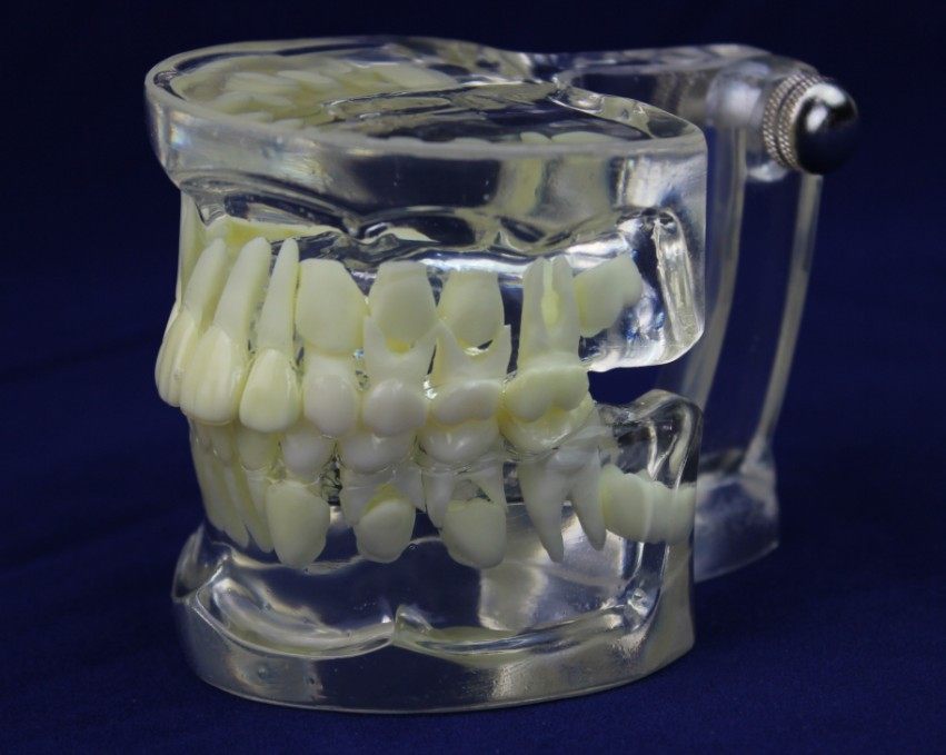 ENOVO頤諾全透明乳恒牙交替模型兒童牙齒列發育指導刷牙模型在類目 電子詞典/電紙書/文化用品, 教學演示/展示告示用品, 教学标本/模型中 - 來自Buy2taobao.com提供專業的淘寶代購服務