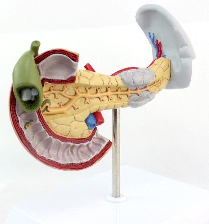 指肠和胆囊病理模型消化系统消化科脾脏模型肝胆胰外科教学演示模型
