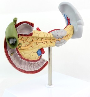 ENOVO颐诺医学用脾脏病理模型疾胰腺十二指肠和胆囊病理模型消化系统消化科脾脏模型肝胆胰外科教学演示模型