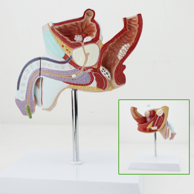 ENOVO颐诺人体男性生殖疾病淋病泌尿系统模型男科常见病前列腺增生模型医患沟通男性生殖模型生殖健康医院