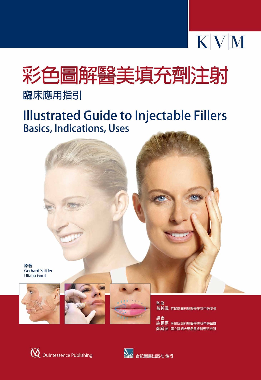 预售【外图台版】彩色图解医美填充剂注射：临床应用指引 / Gerhard Sattler、Uliana Gout-作；曾铭仪-监修 合记图书出版社