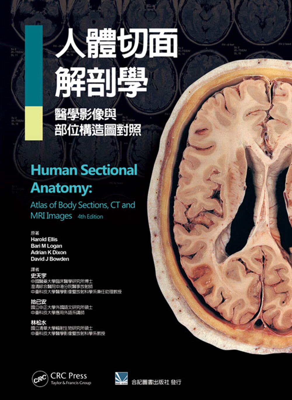 预售【外图台版】人体切面解剖学:医学影像与部位构造图对照 / 史天宇 合记