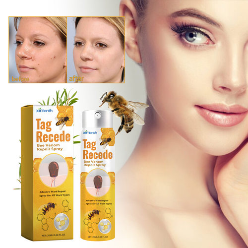 Bee Venom Wart Treatment Spray Improve Flesh Moles Repair Sm